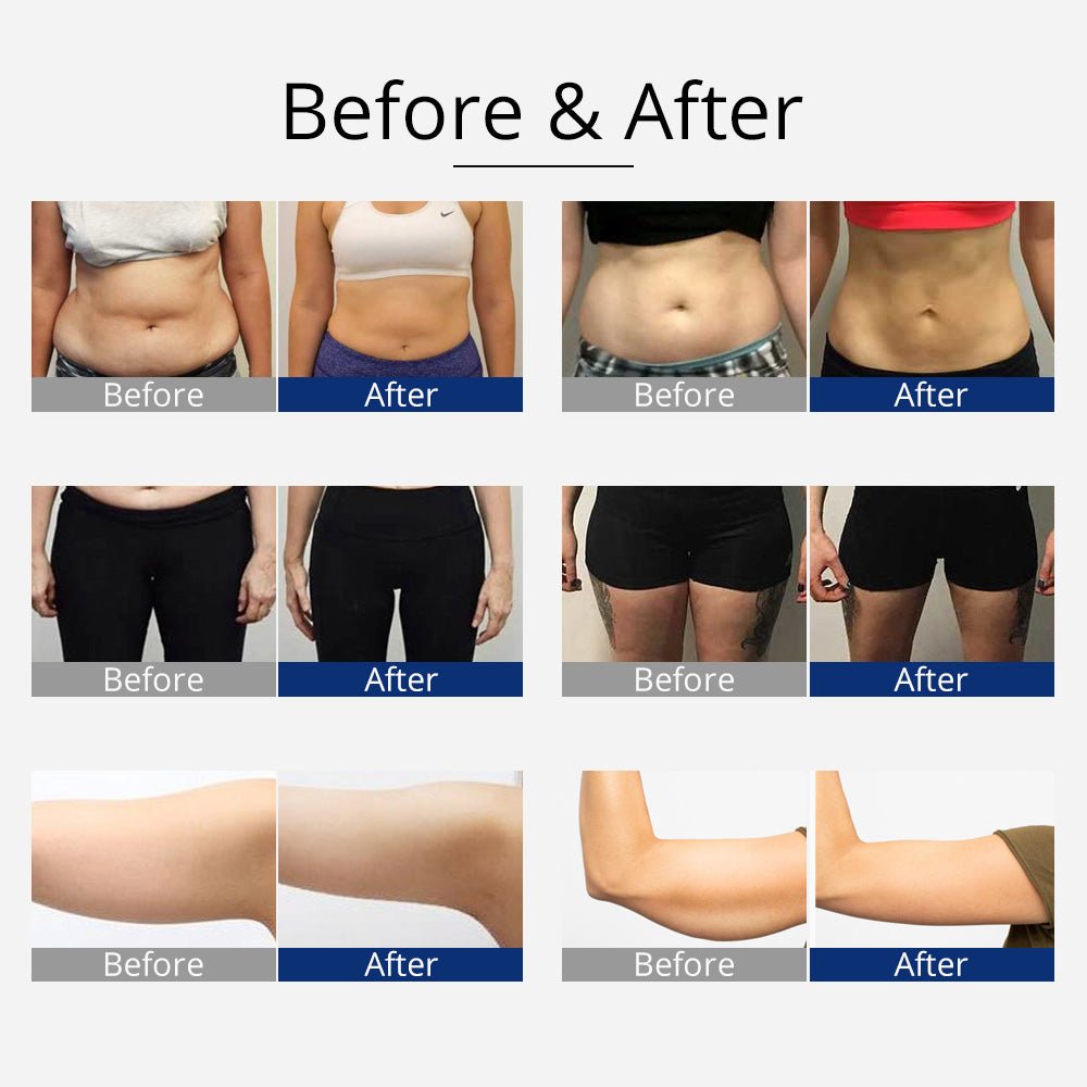 Revolutionary 360° RF Ultrasonic Cavitation Vacuum for Body Slimming and Sculpting