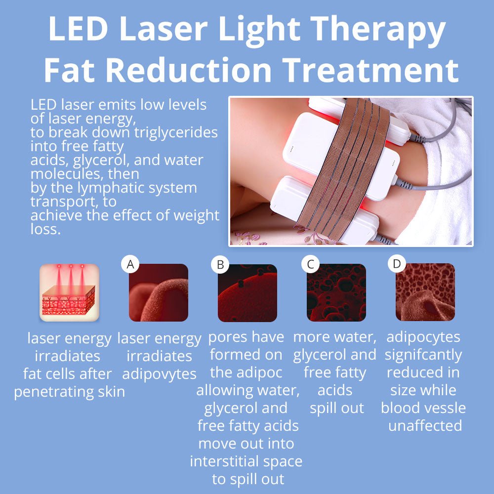 6-in-1 Shape Tactics: Transform Your Body with Cavitation, Lipo Laser, RF & Cryolipolysis