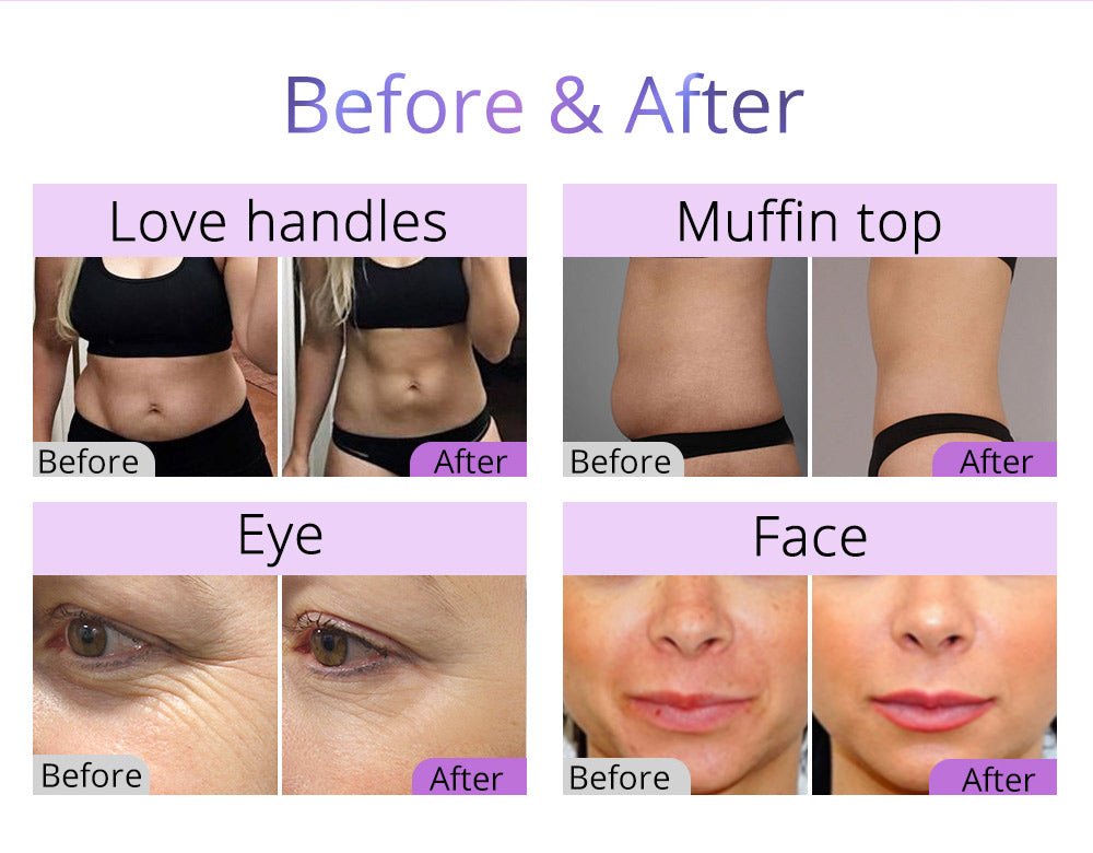 Shape Tactics 5-in-1 Fat Burning & Body Contouring Device