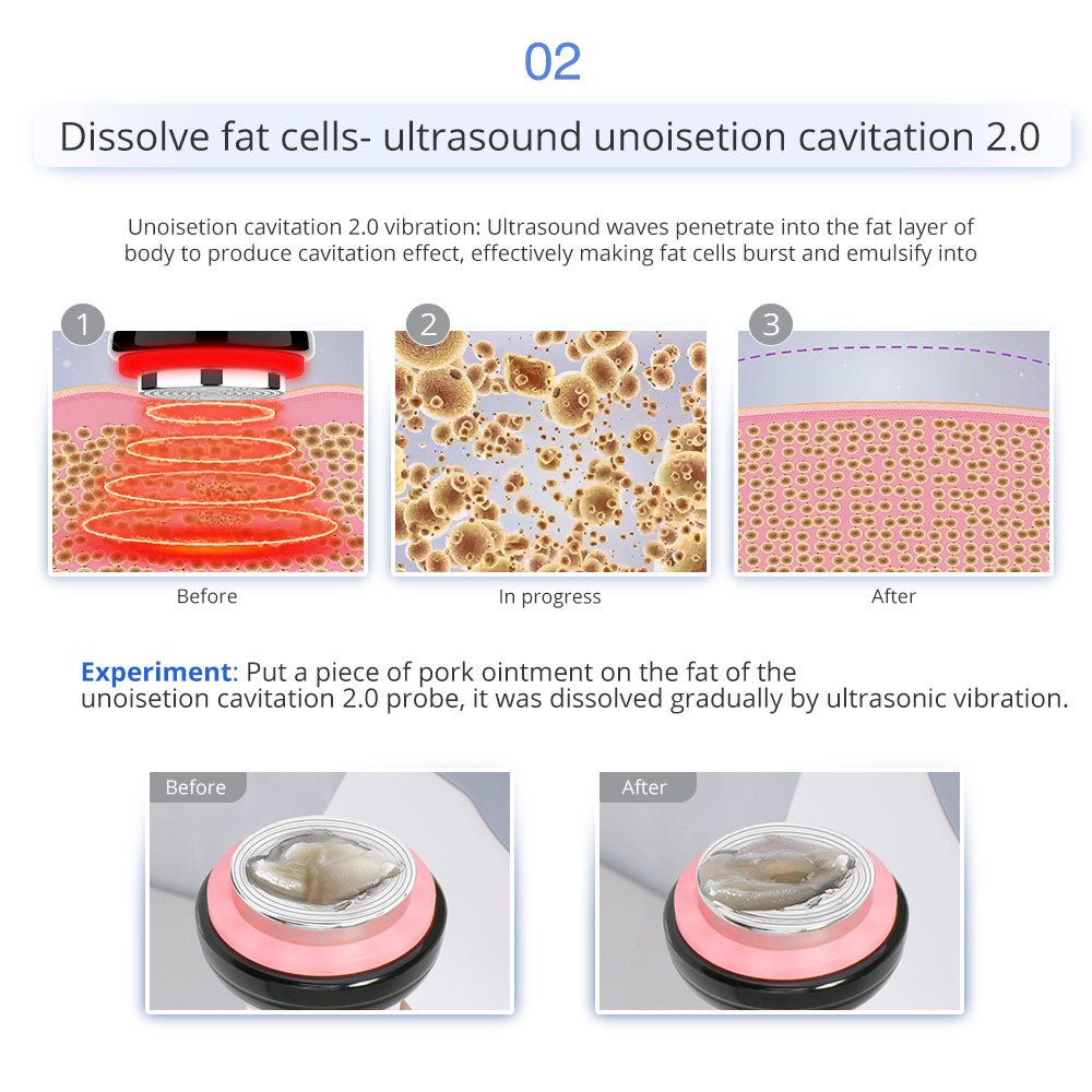 7-in-1 Ultrasonic Cavitation RF Hot Cold Beauty Machine for Body Sculpting