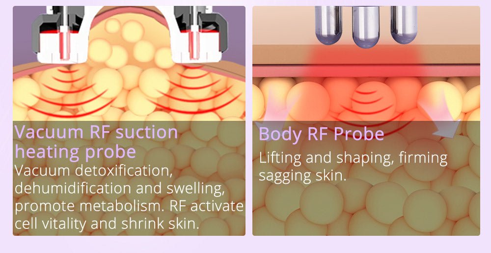 Slimify Pro 6-in-1 Ultrasonic Lipo Cavitation RF Body Sculptor