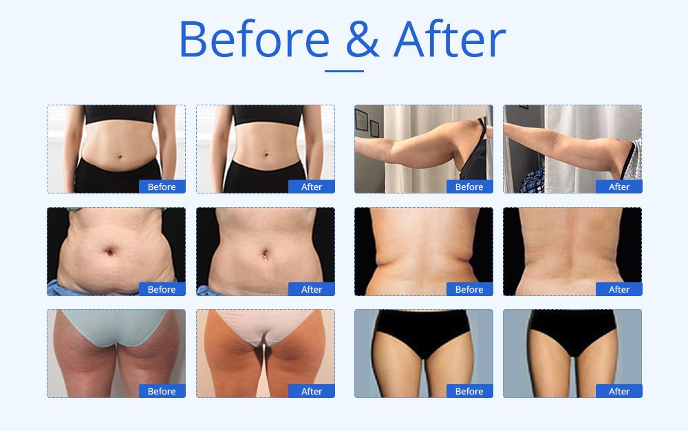 Shape Tactics 6-in-1 Advanced Body Sculpting Device: Unleash Your Dream Body