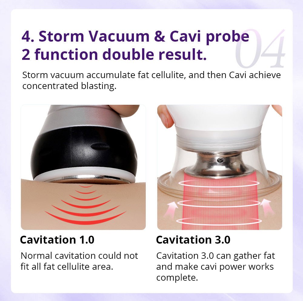 Shape Tactics Cavstorm 40K Cavitation 3.0 with Microcurrent Technology - The Ultimate Fat Reduction Solution