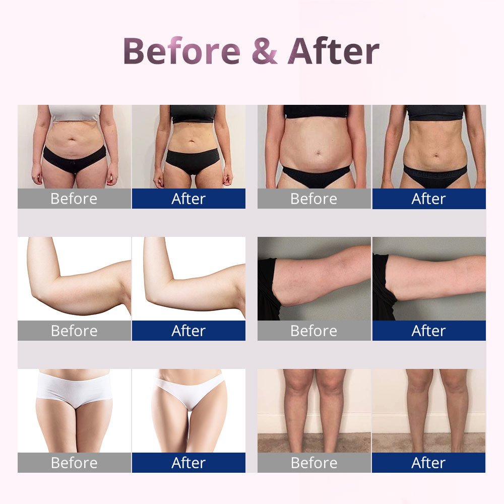 Revitalize with Shape Tactics - 10 Pad Laser Lipo Therapy