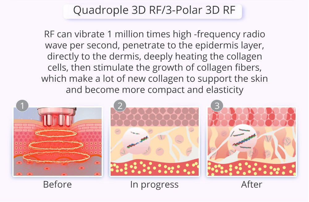 9-in-1 Body Shaping Wonder: Lipo, Microcurrent, Photon & Ultrasonic Cavitation
