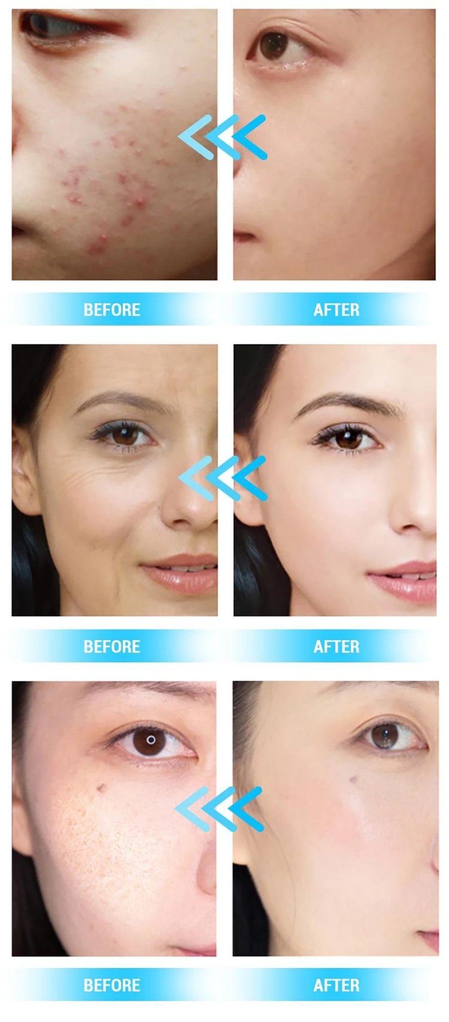 Revitalize Your Skin with Shape Tactics Advanced 14-in-1 Hydro Dermabrasion & PDT Light Therapy