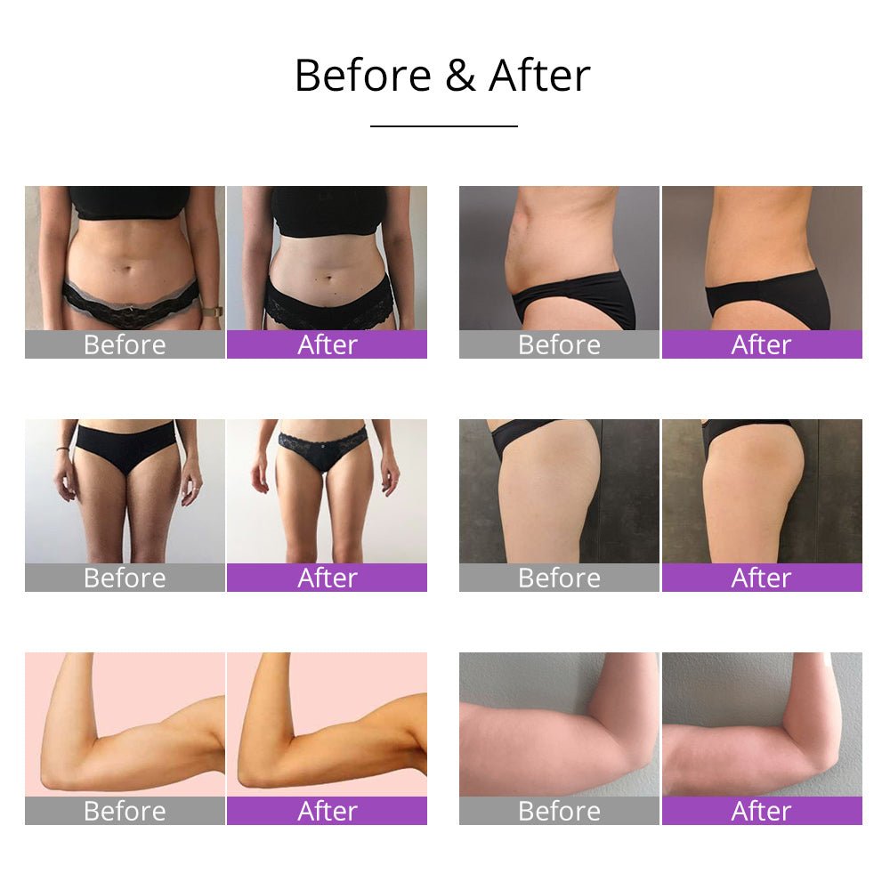 Shape Tactics Ultrasonic Cavitation RF 5MW Lipo Laser Slimming Device - Transform Your Body Now