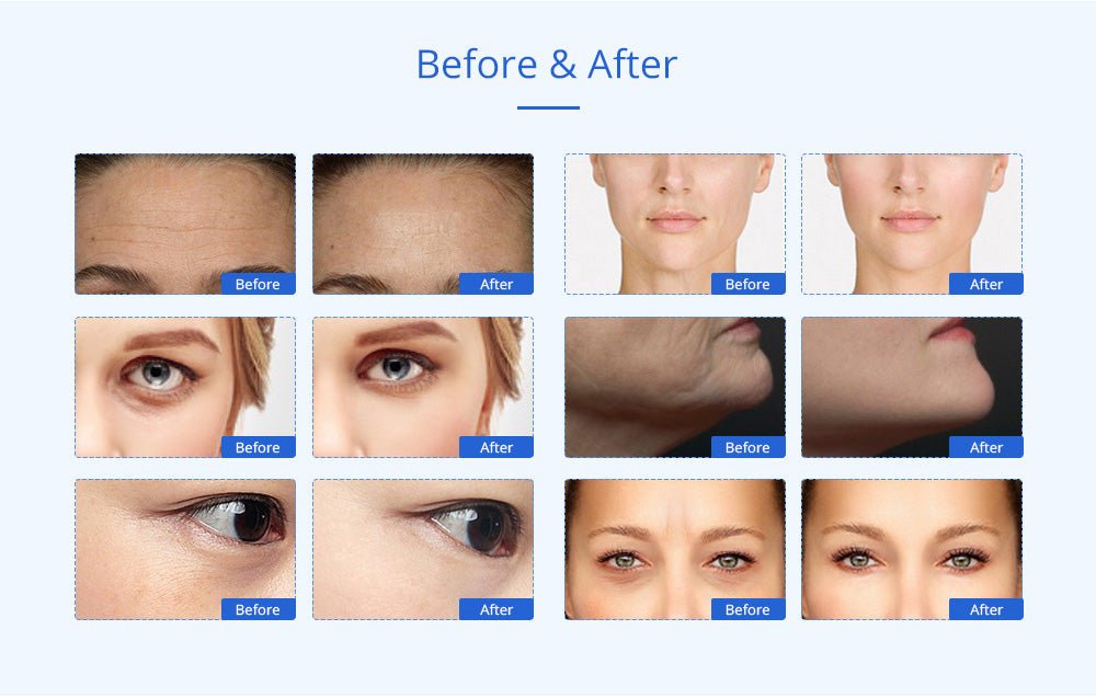 Shape Tactics - 8-in-1 Advanced Body Contouring Machine: Unleash Your Dream Body Now!
