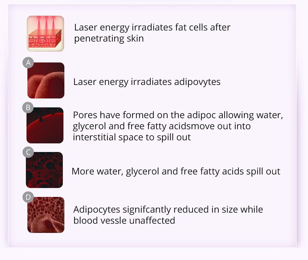 9-in-1 Body Shaping Wonder: Lipo, Microcurrent, Photon & Ultrasonic Cavitation