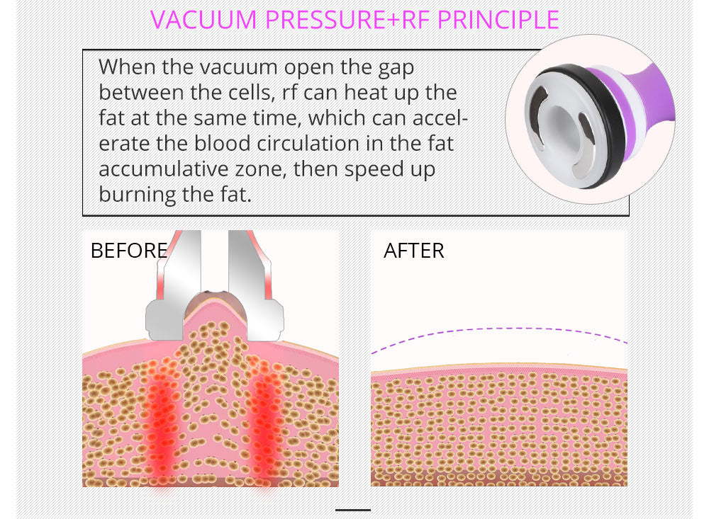 Shape Tactics All-in-One Body Slimming and Skin Tightening Machine