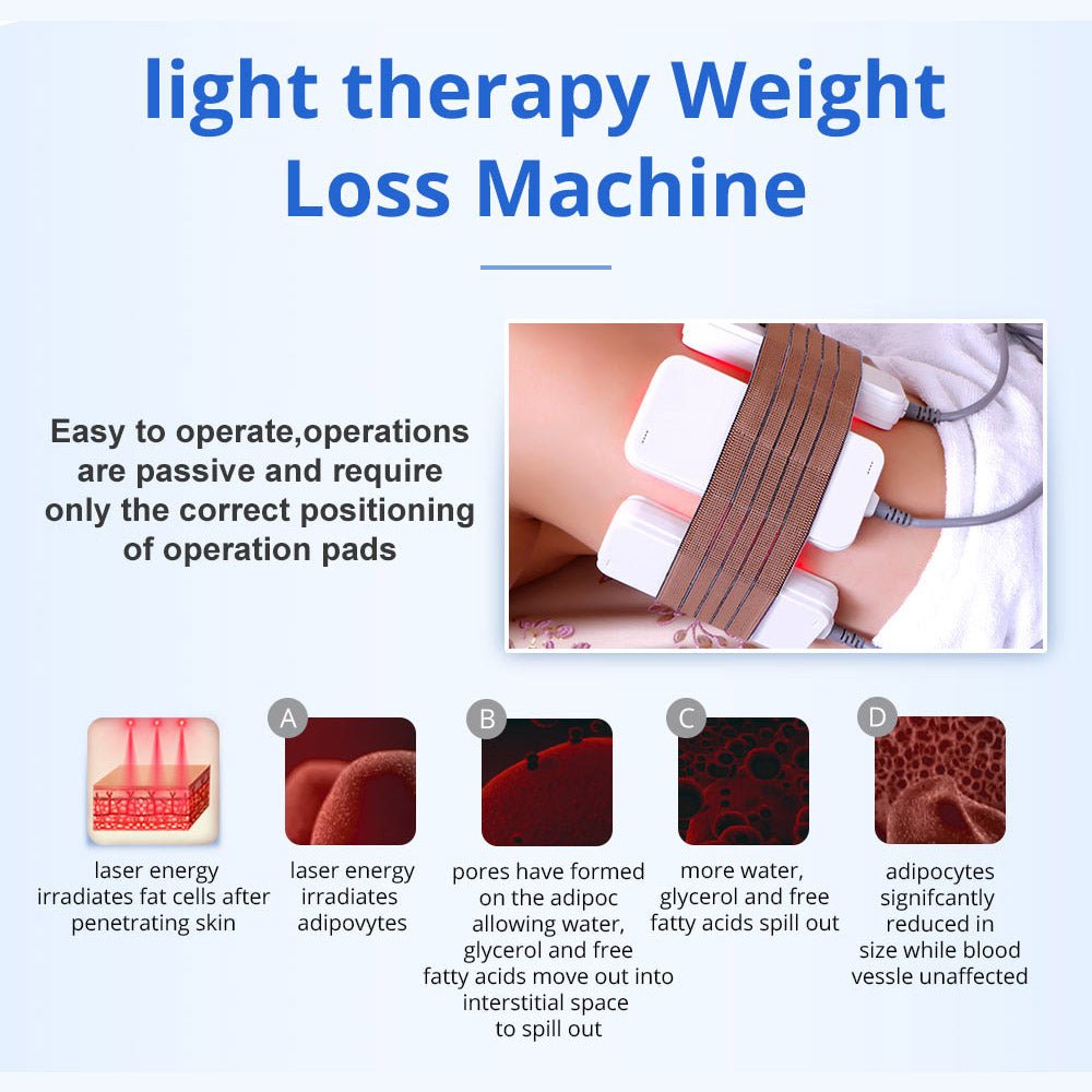 5-in-1 RF 40K Cavitation Fat Reduction and Skin Tightening Device