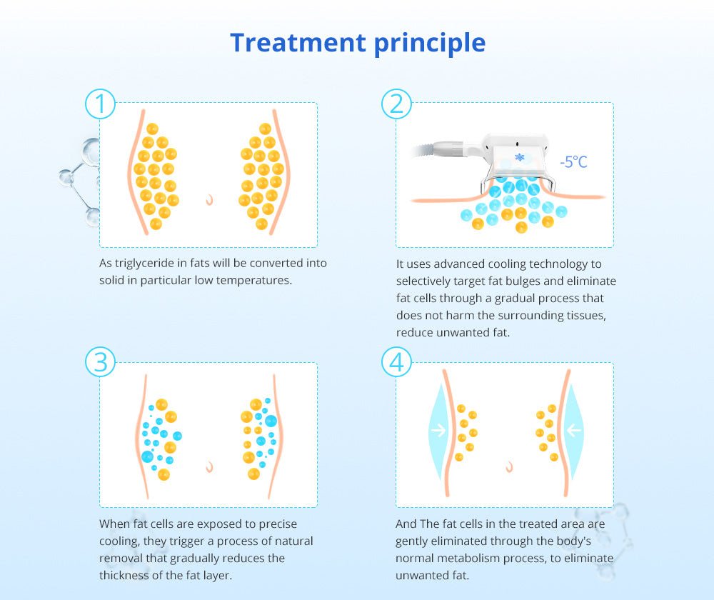 Shape Tactics - Advanced Fat Freezing Slimming Machine for Stand-Up Use
