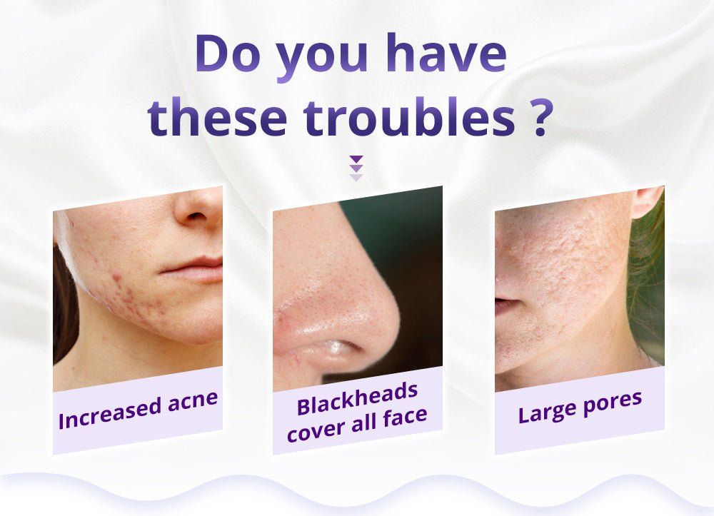 Shape Tactics Diamond Microdermabrasion Machine - Your Key to Flawless Skin