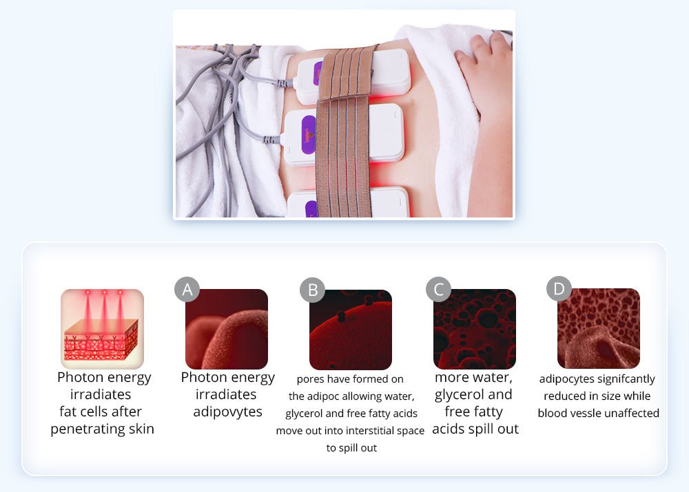Shape Tactics 6-in-1 Advanced Body Sculpting Device: Unleash Your Dream Body