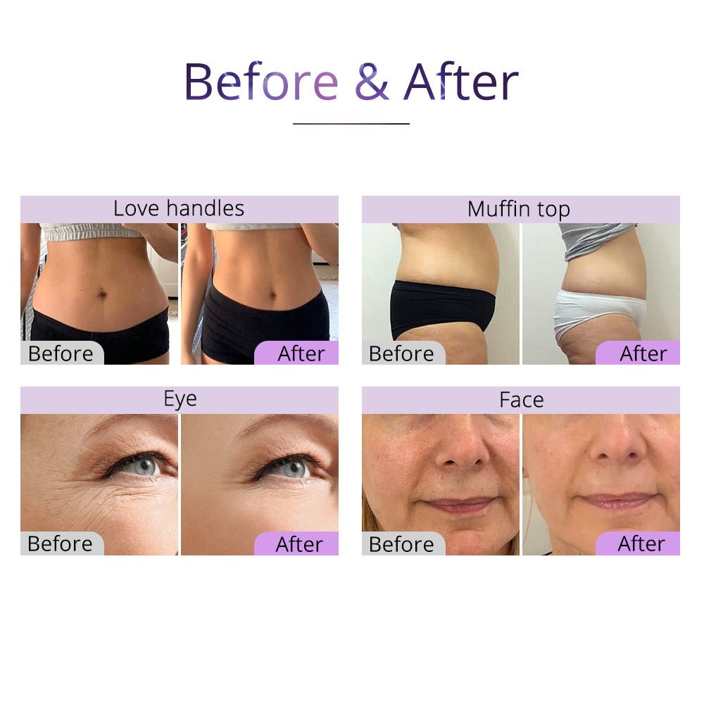 Advanced Shape Tactics 5-in-1 Fat Loss & Body Sculpting System