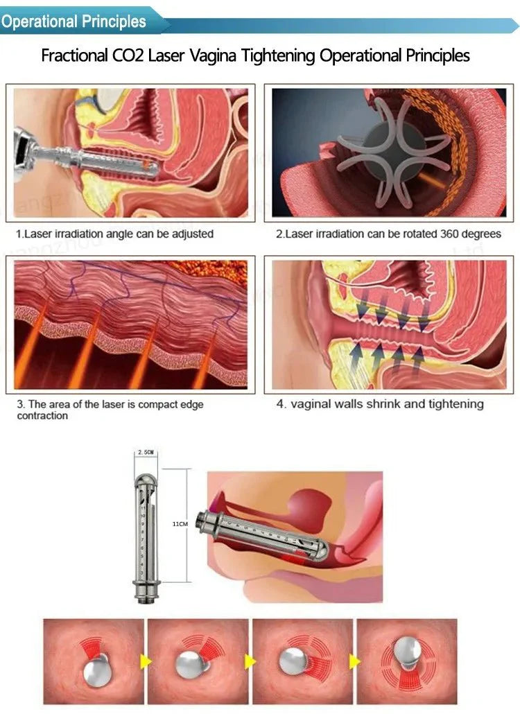 Shape Tactics CO2 Dot Laser: Your Skin Rejuvenation and Microvascular Reconstruction Solution