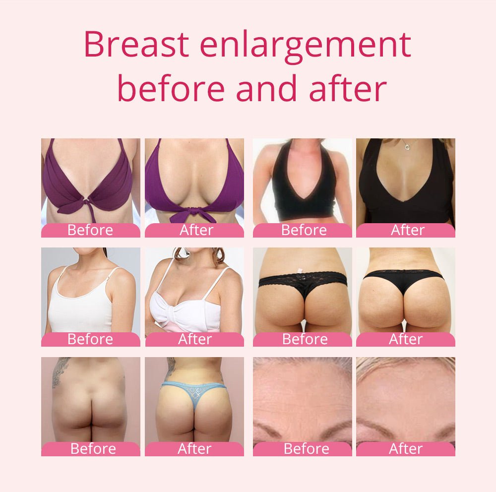 Shape Tactics - BBL Vacuum Suction for Ultimate Beauty Enhancement