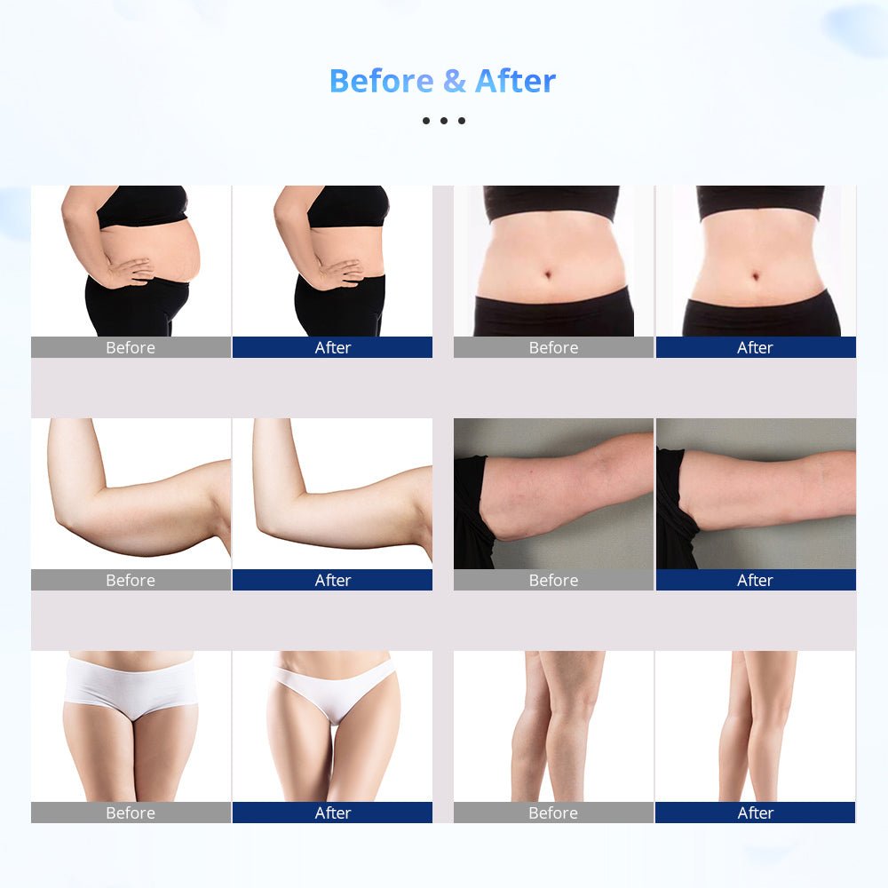 Advanced 12-Pad LED Laser with 160MW Power for Precise Treatments