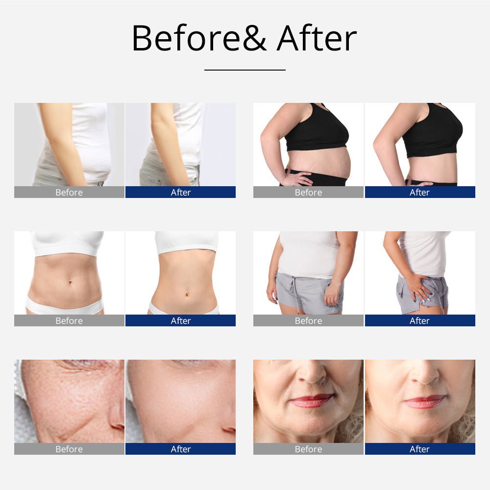 Shape Tactics 5-in-1 Smart Body Sculpting Machine