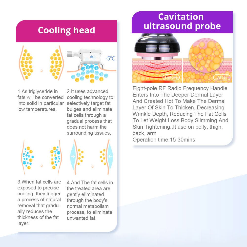 5-in-1 RF 40K Cavitation Fat Reduction and Skin Tightening Device