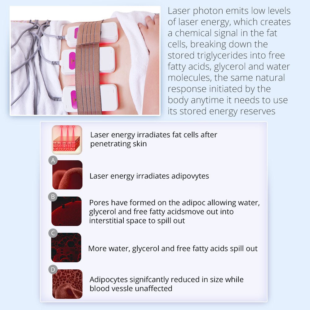 Advanced 5-in-1 Body Cryolipolysis 40K RF Lipo Laser - Shape Tactics