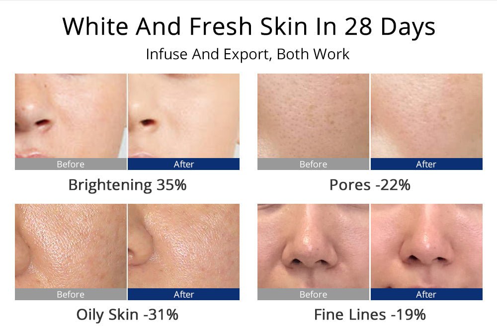 Revitalize Your Skin with the 5-in-1 Diamond Water Peel Microdermabrasion Machine