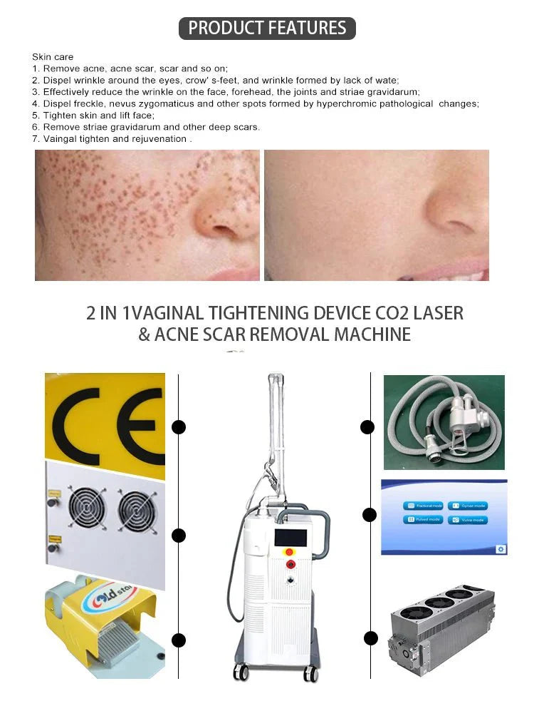 Shape Tactics CO2 Dot Laser: Your Skin Rejuvenation and Microvascular Reconstruction Solution