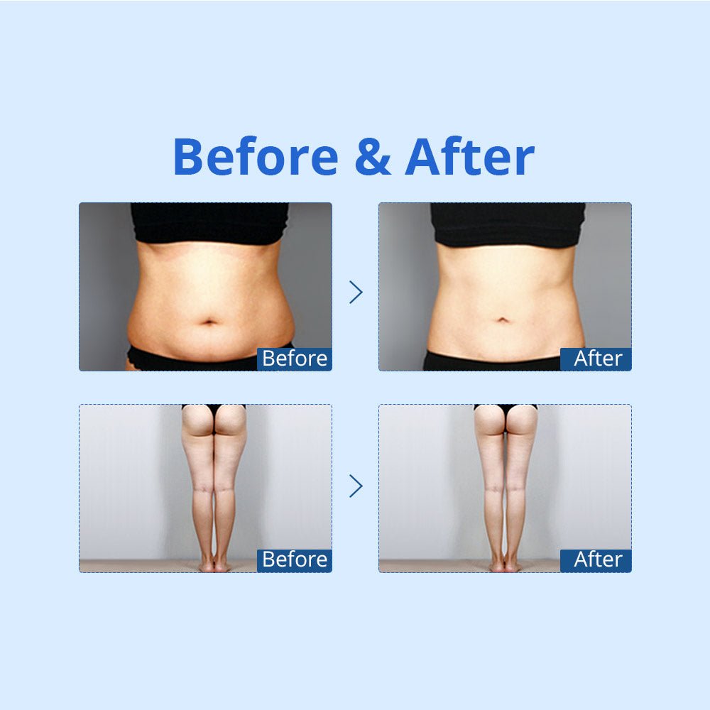 Shape Tactics - Cryolipoysis Cold Vacuum Fat Freeze Shaping Machine: Transform Your Body with Non-Invasive Fat Reduction