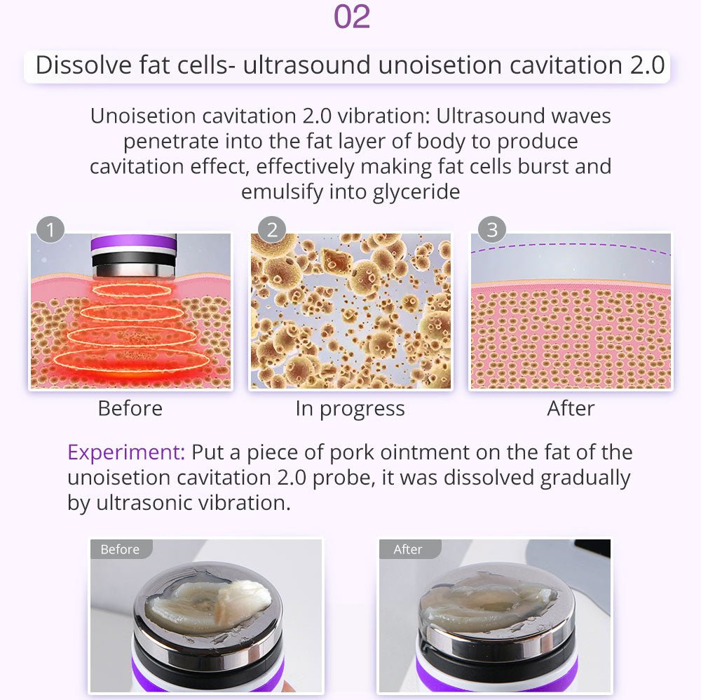 9-in-1 Body Shaping Wonder: Lipo, Microcurrent, Photon & Ultrasonic Cavitation