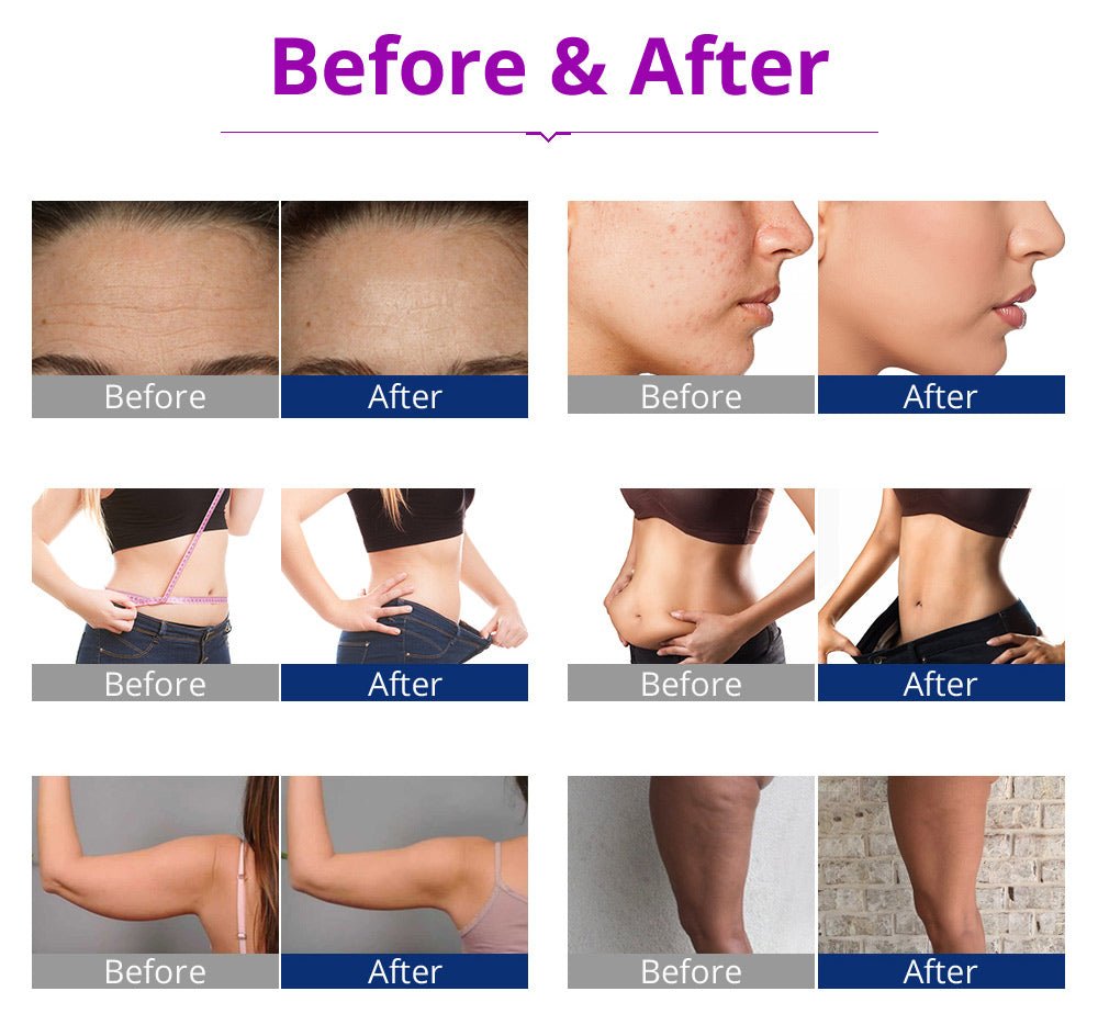 Shape Tactics All-in-One Body Sculpting Machine