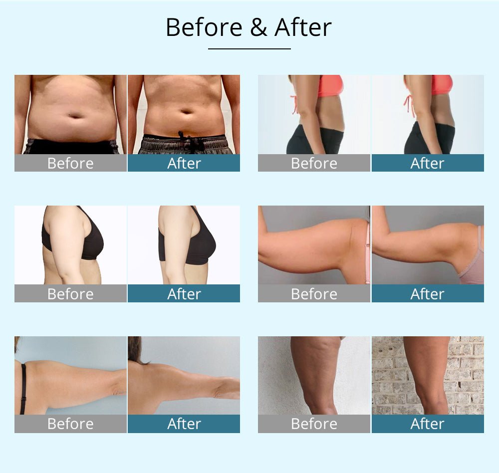 Shape Tactics 9-in-1 Body Slimming Wonder Machine