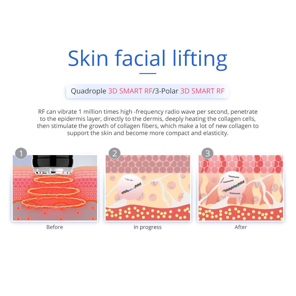7-in-1 Ultrasonic Cavitation RF Hot Cold Beauty Machine for Body Sculpting