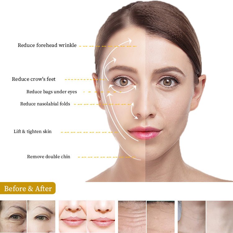 Shape Tactics Pro 7D HIFU: Lift & Sculpt Your Way to Youthful Skin