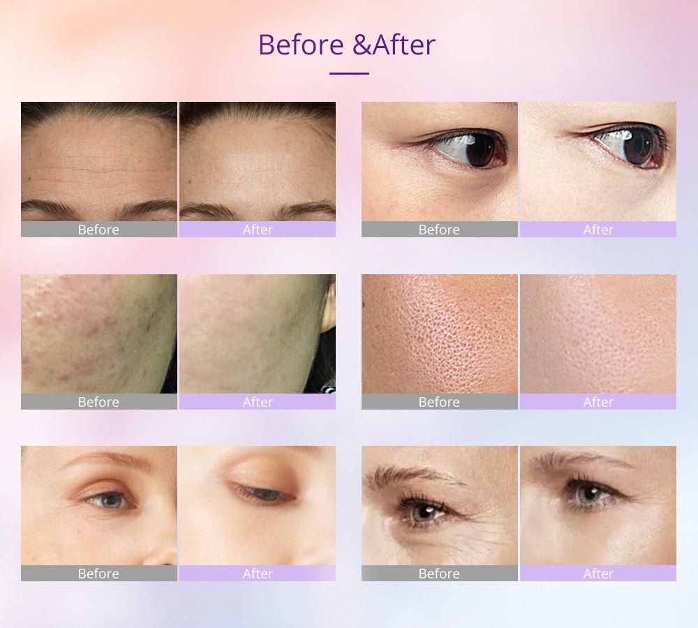 Shape Tactics Photon LED Facial Care Micro Current Beauty Device - Transform Your Skin