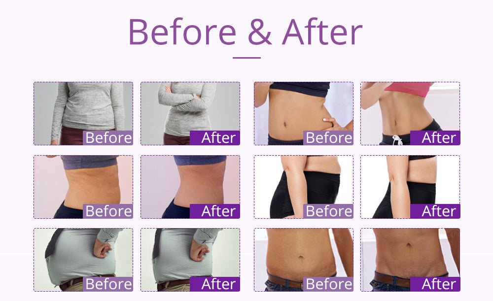 9-in-1 Body Shaping Wonder: Lipo, Microcurrent, Photon & Ultrasonic Cavitation