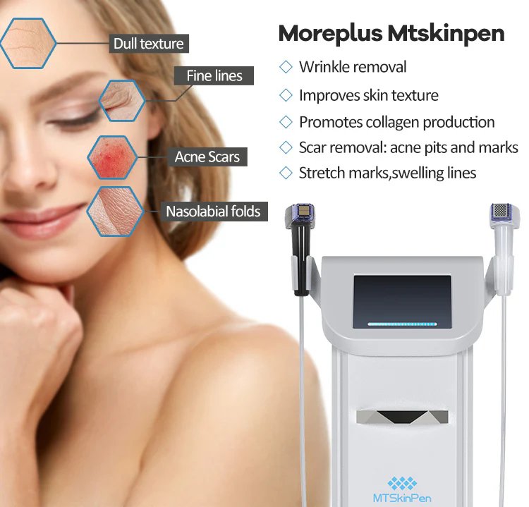 Shape Tactics Advanced Gold RF 8-Depth Micro-Needling: Skin Rejuvenation Powerhouse