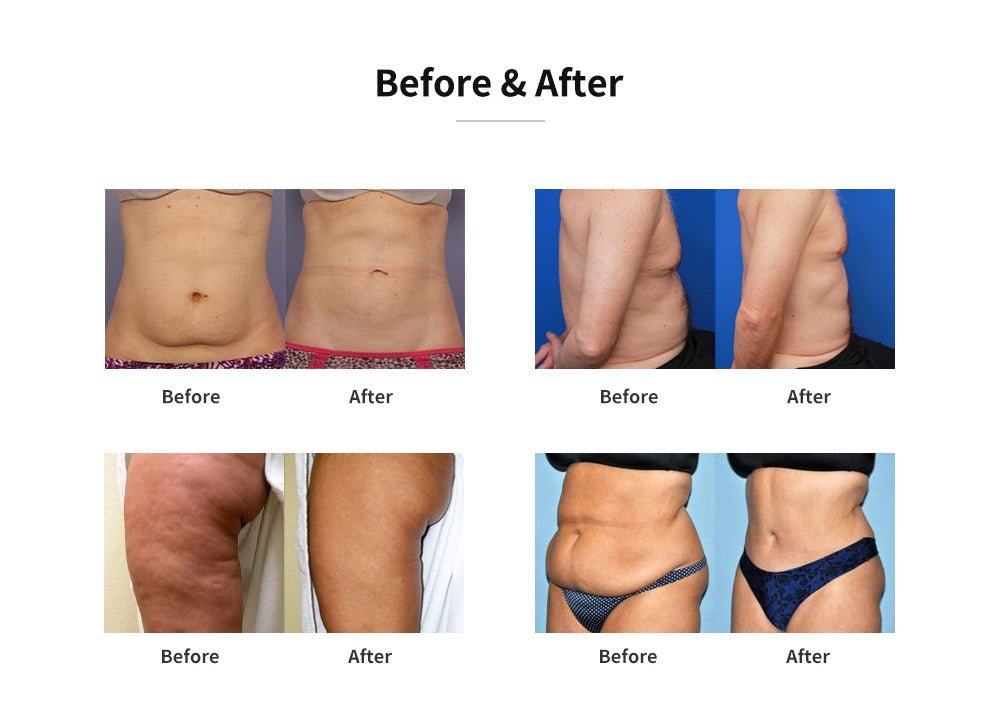 Shape Tactics - Dual Handle Fat Freezing, Skin Tightening Wonder Machine