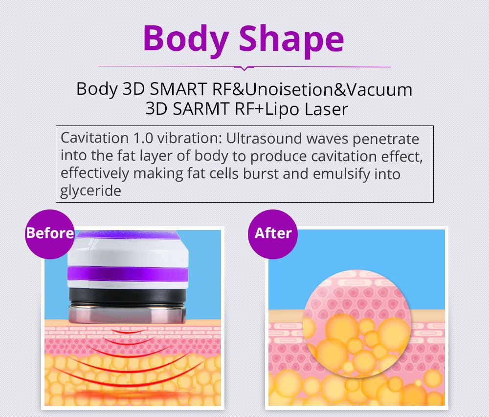 Shape Tactics 6-in-1 Advanced Cavitation 40K LED Radio Frequency Beauty Device