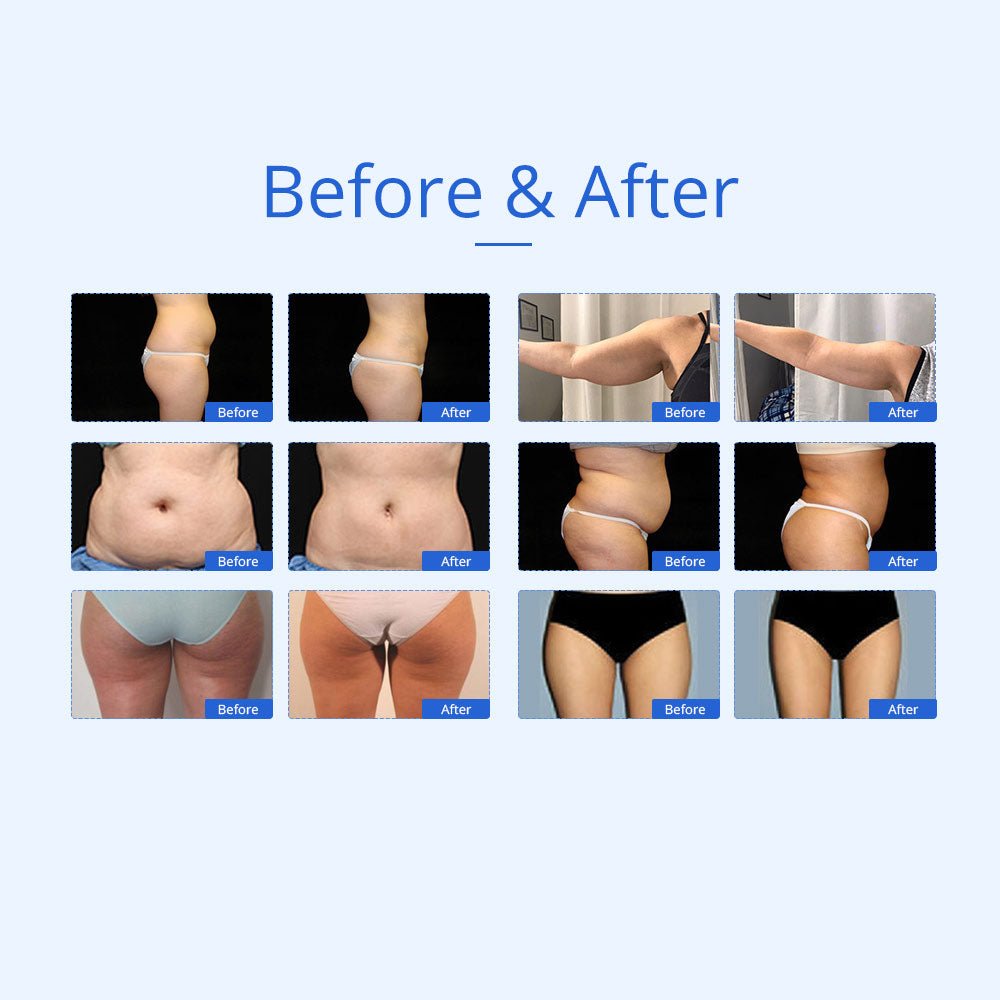7-in-1 Ultrasonic Cavitation RF Hot Cold Beauty Machine for Body Sculpting