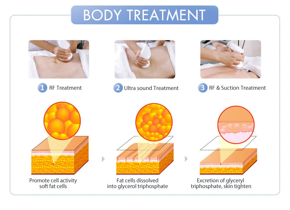Shape Tactics S-Shape Pro: The Ultimate 30K Polar RF Massager for Body Transformation