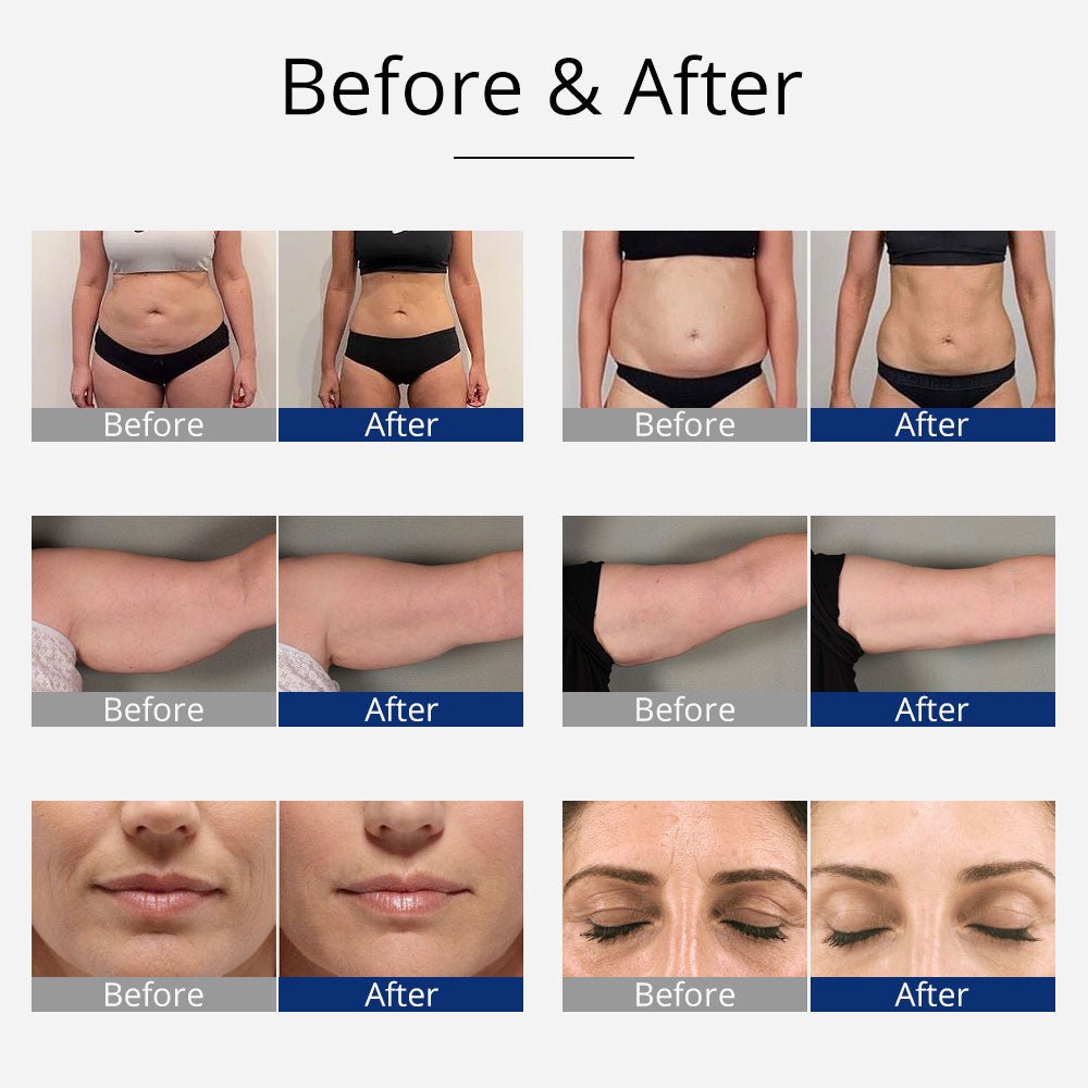 Shape Tactics 4-in-1 Body Slimming: Unlock Your Dream Body Now!
