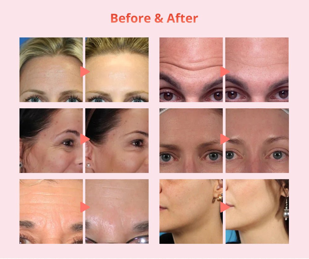 Advanced Skin Rejuvenation and Fat Burning Machine