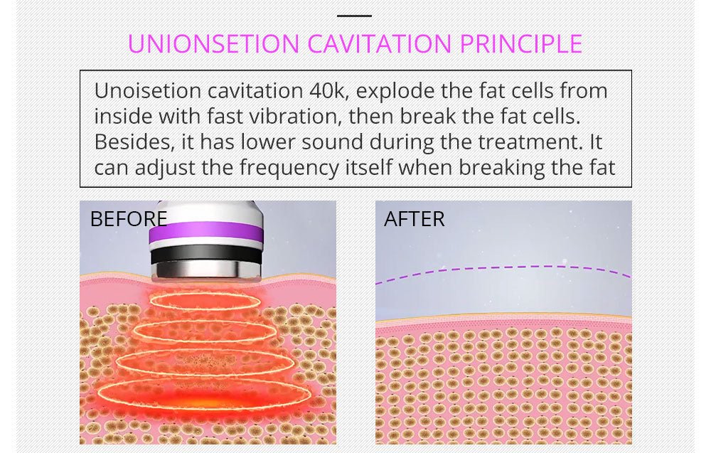 Shape Tactics All-in-One Body Slimming and Skin Tightening Machine