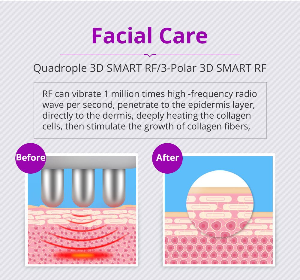 Shape Tactics 6-in-1 Advanced Cavitation 40K LED Radio Frequency Beauty Device