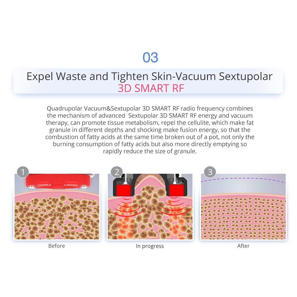 7-in-1 Ultrasonic Cavitation RF Hot Cold Beauty Machine for Body Sculpting