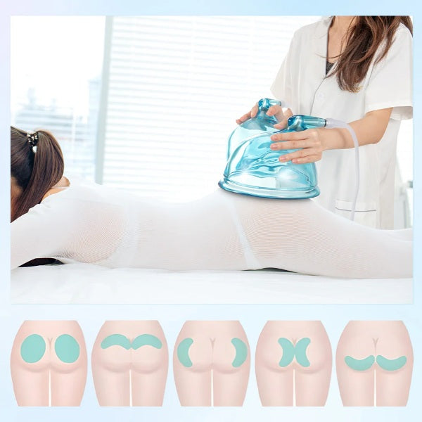 Revitalize Your Skin with Shape Tactics - 21cm Vacuum BBL Suction Therapy Cups