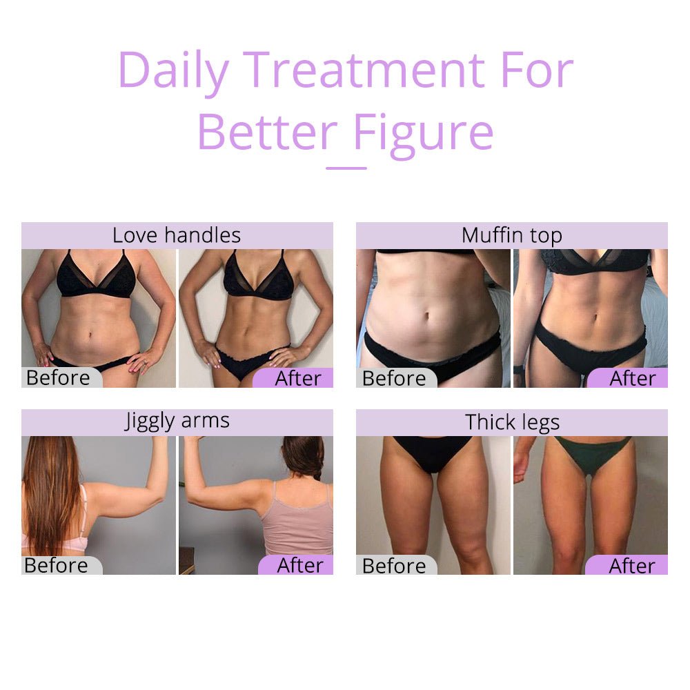 Shape Tactics - 2.5 Ultrasonic Cavitation Slimming Wonder