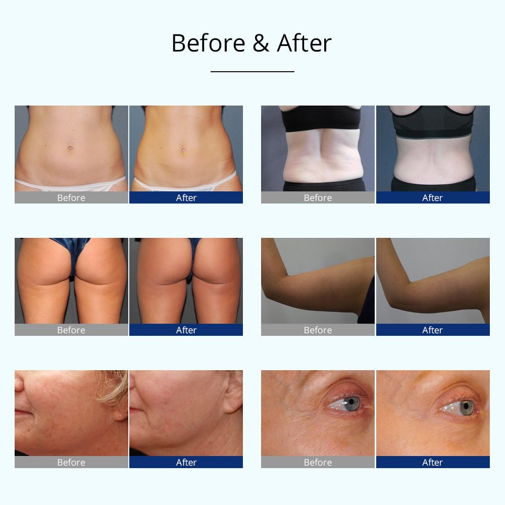 Shape Tactics All-in-One Body Sculpting Machine