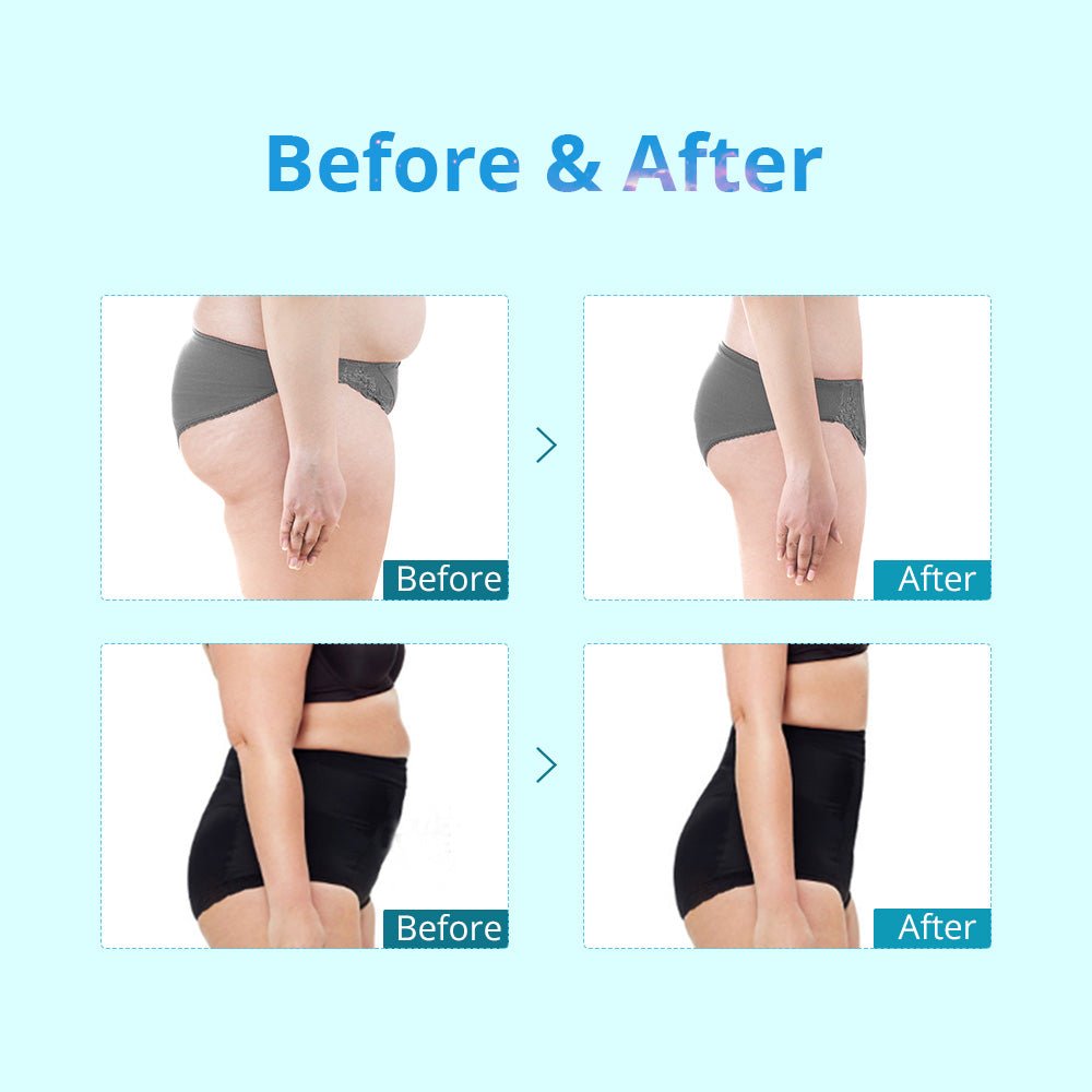Shape Tactics Portable Double-Handle Cryolipolysis Fat Freezing Body Sculpting Wonder Device