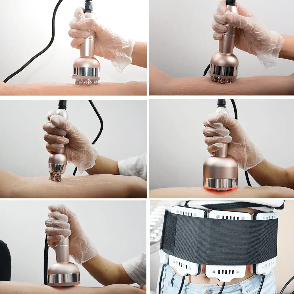 Shape Tactics ProElite 40K RF Lipo Laser: Transform Your Body and Skin